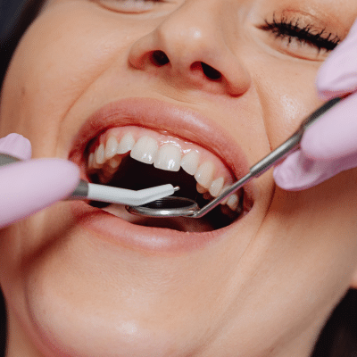Metal vs ceramic dental crowns: which is best for you? 7 A close-up of a woman's mouth with dental instruments checking her teeth, representing metal vs ceramic dental crowns